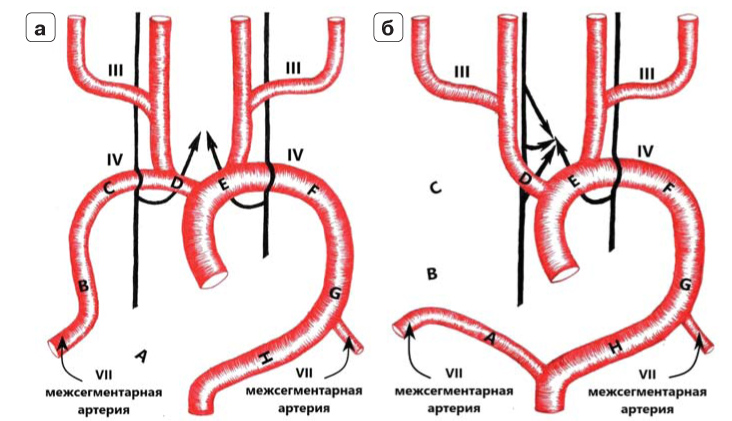 Межсегментарные артерии. Артериальные дуги желудка. Сосудистое русло человека.